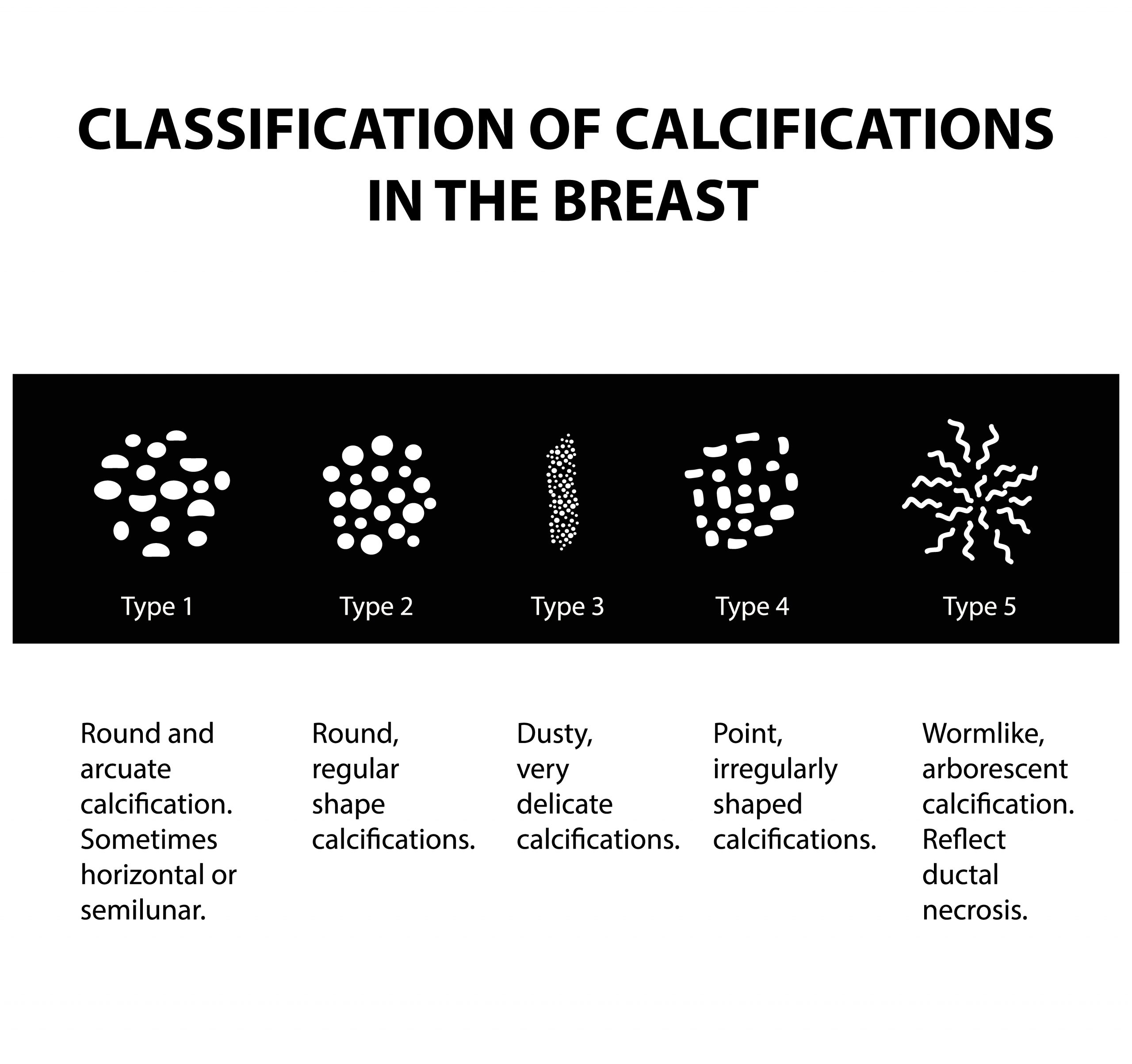 Your Guide To Understanding Breast Calcifications Fairfield Medical