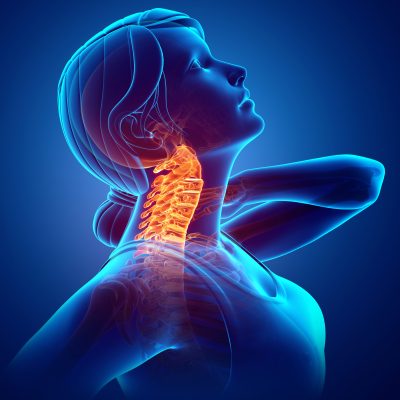 chronic neck pain illustration