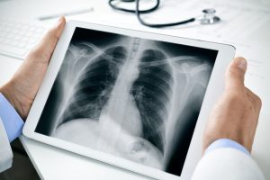 Chest Xray Review